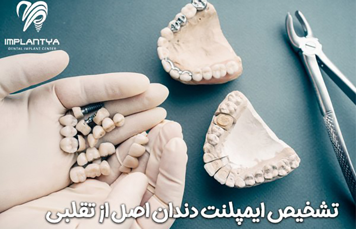 تشخیص ایمپلنت دندان اصل از تقلبی : جستجوی حقیقت در لبخند شما!