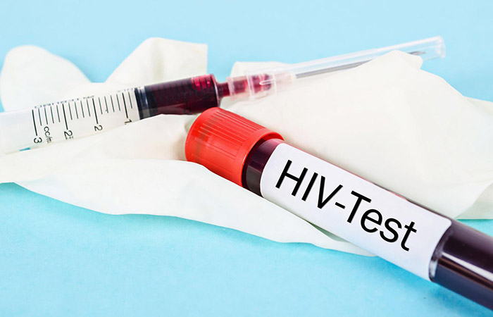 انواع آزمایش hiv
