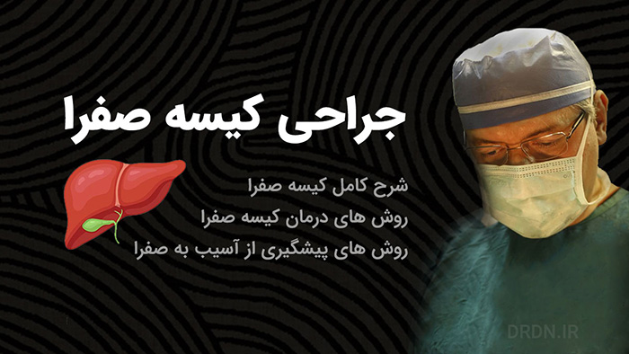 بهترین جراح کیسه صفرا